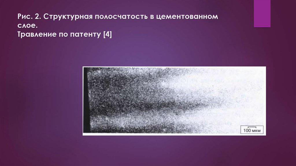 Рис. 2. Структурная полосчатость в цементованном слое. Травление по патенту [4]