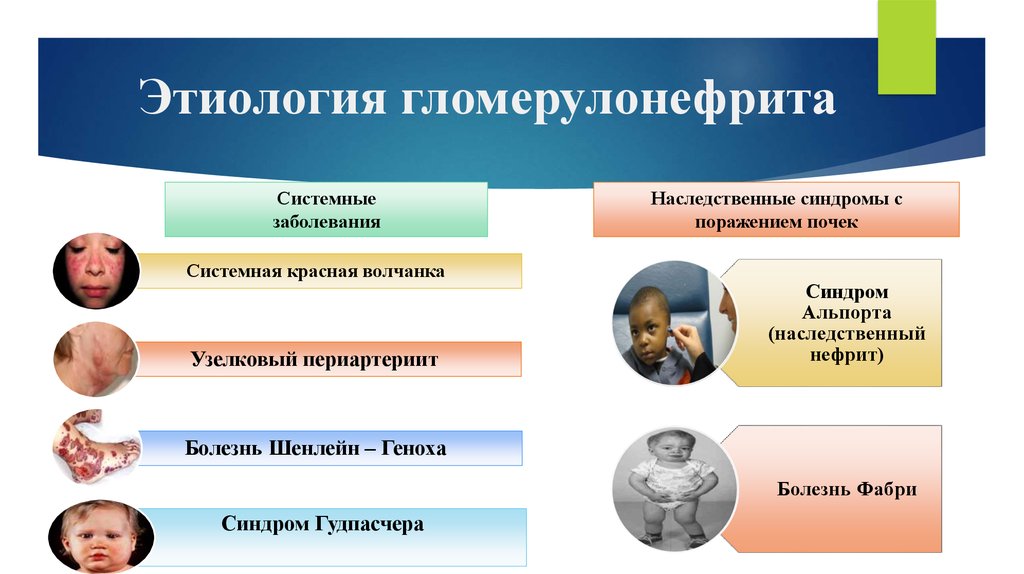 Гломерулонефриты у детей презентация