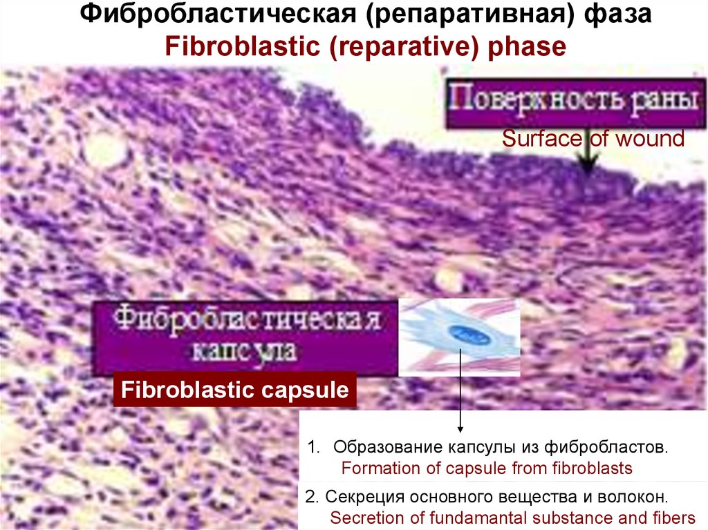 Пролиферация это простыми словами. Пролиферация фибробластов гистология. Фибробластоподобные клетки гистология. Фибробластическая фаза воспаления. Функции фибробластов соединительной ткани.