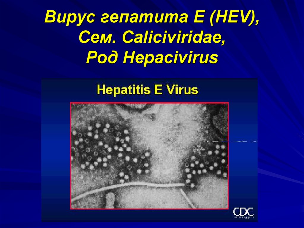 Вирусные гепатиты e. Вирусный гепатит е. Вирус гепатита е. Вирусный гепатит е возбудитель. Структура вируса гепатита е.