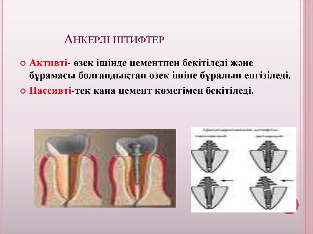 Анкерлі штифтер