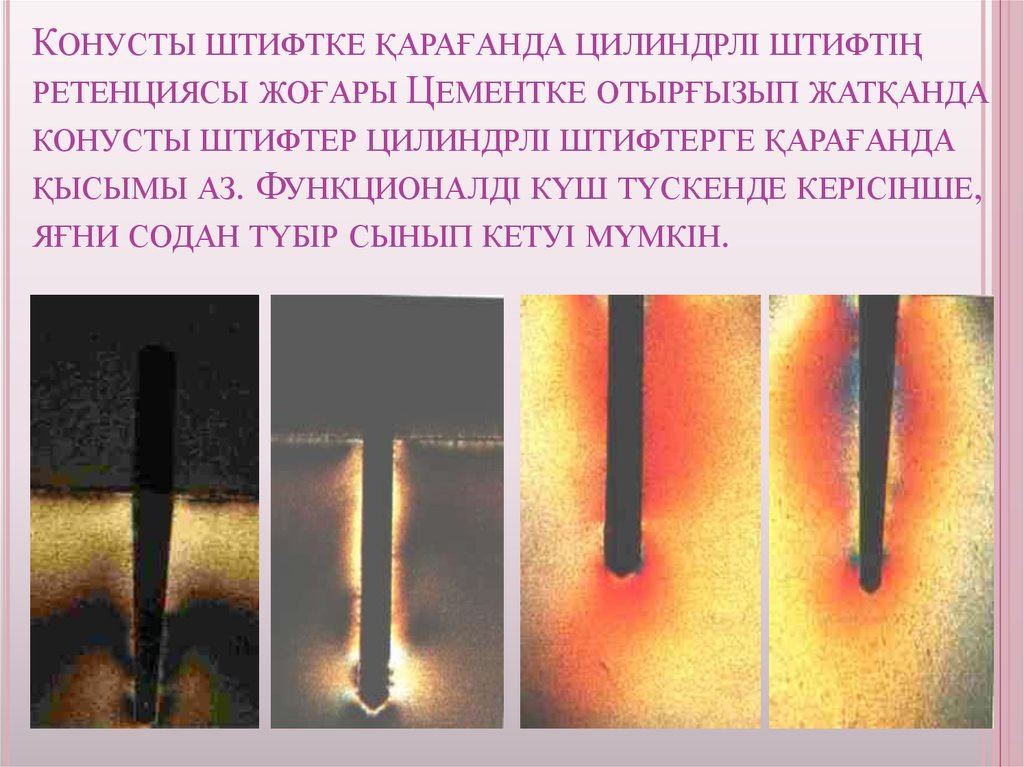 Конусты штифтке қарағанда цилиндрлі штифтің ретенциясы жоғары Цементке отырғызып жатқанда конусты штифтер цилиндрлі штифтерге