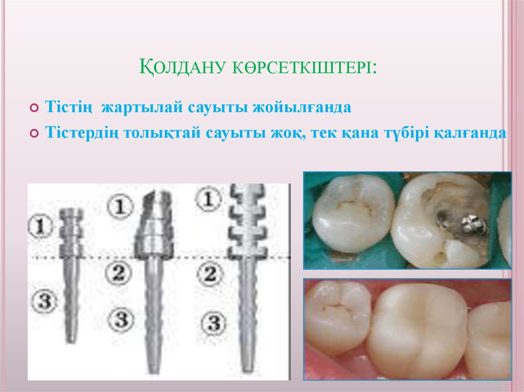 Қолдану көрсеткіштері: