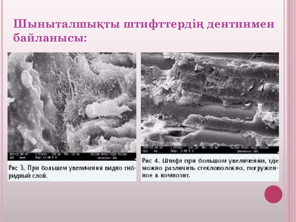 Шыныталшықты штифттердің дентинмен байланысы: