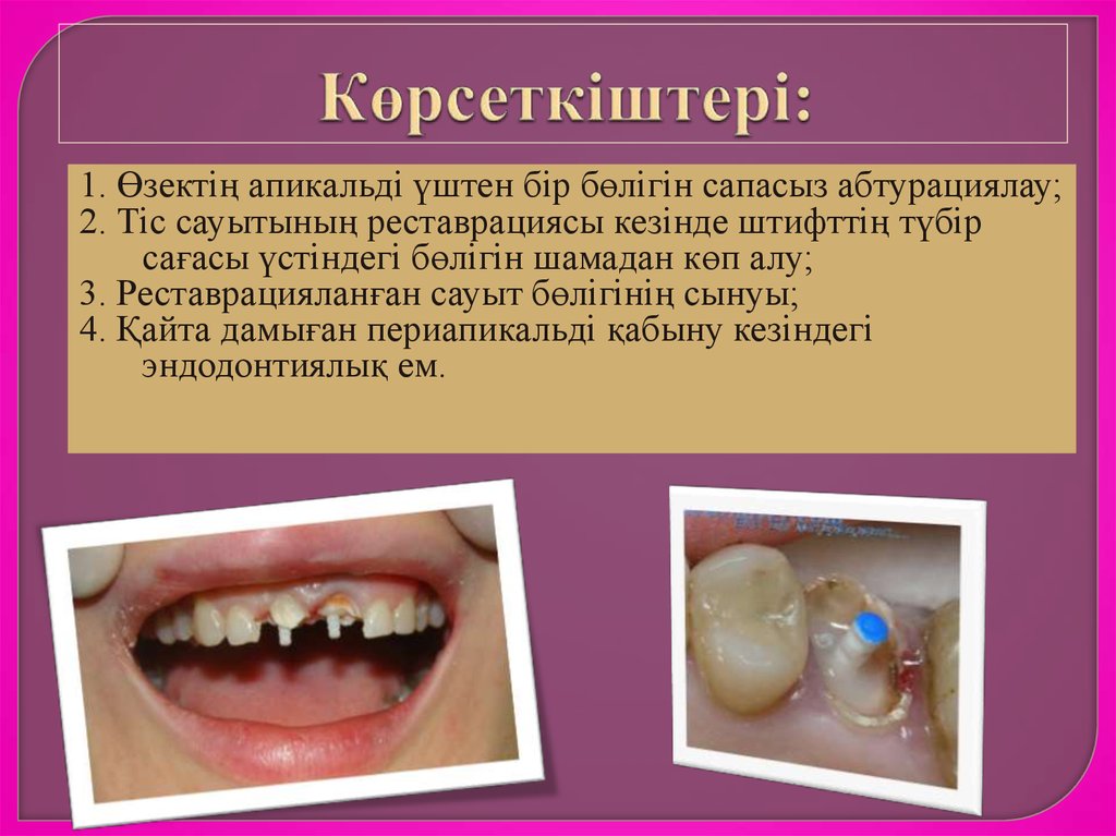 Көрсеткіштері: