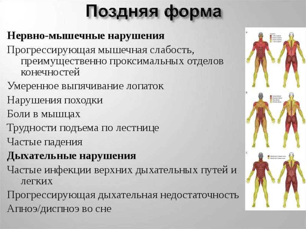 Болезнь помпе презентация