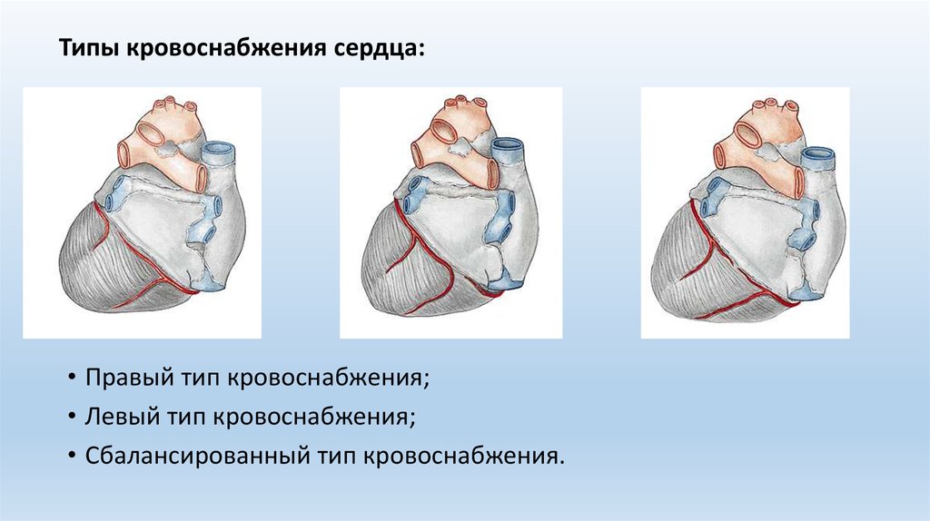 Правая тип. Типы артериального кровоснабжения сердца. Типы коронарного кровоснабжения. Тип кровоснабжениясержца. Левовенечный Тип кровоснабжения сердца.