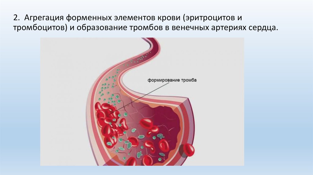 Патофизиология системы кровообращения презентация