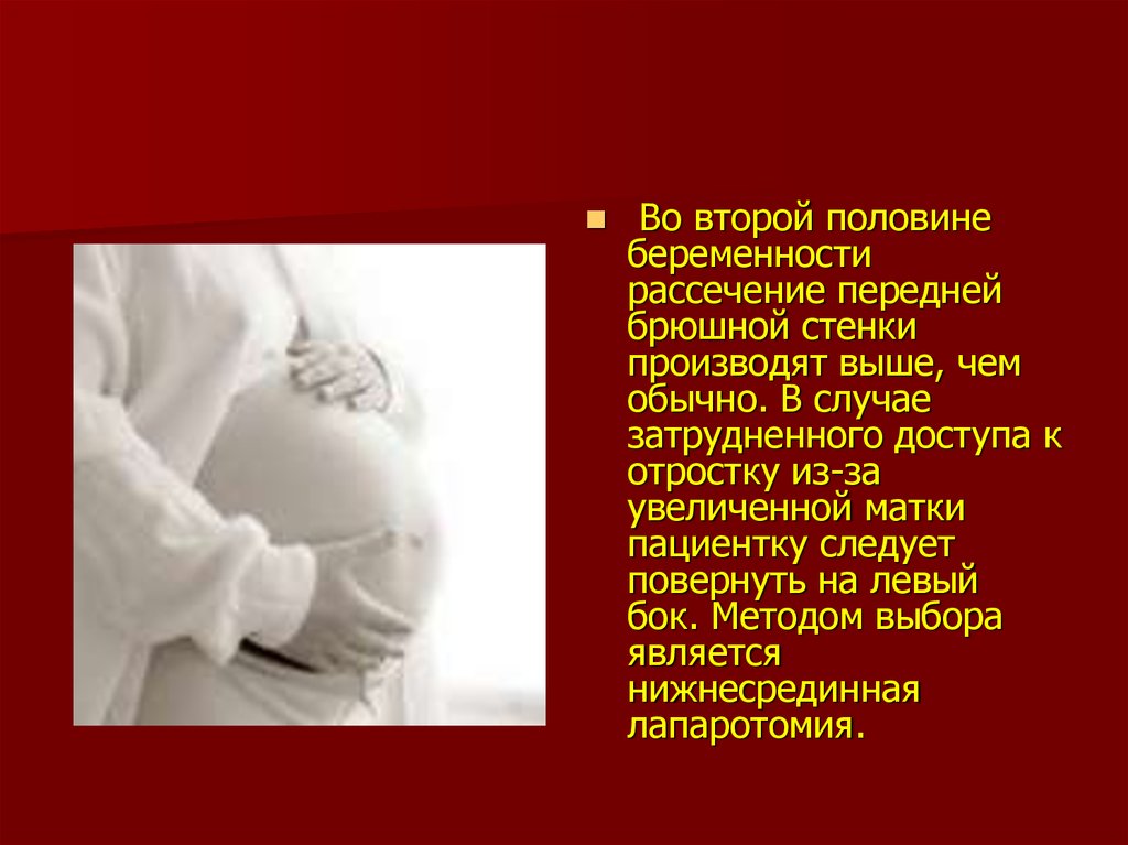 Острый аппендицит у беременных