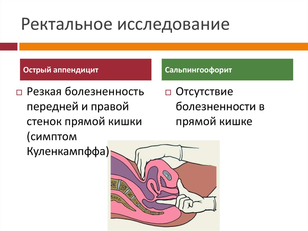 Ректальное исследование. Ректальное исследование при остром аппендиците. Пальцевое исследование прямой кишки при аппендиците. Пальцевое ректальное обследование при остром аппендиците. Показания к ректальному исследованию.