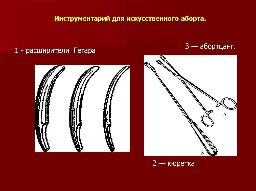 Признак горвица гегара при беременности