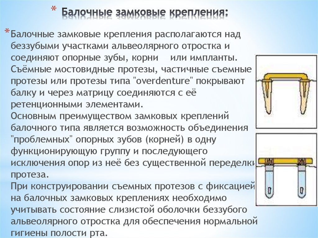 Виды ортопедических конструкций