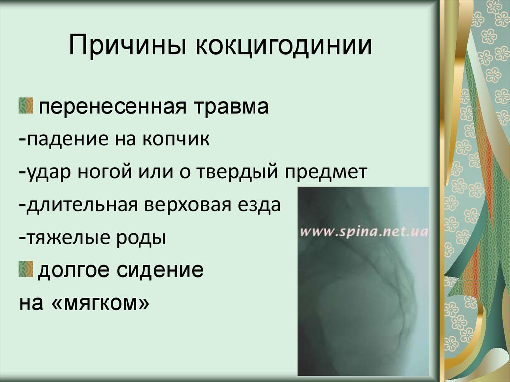 Кокцигодиния. Причины кокцигодинии - презентация онлайн