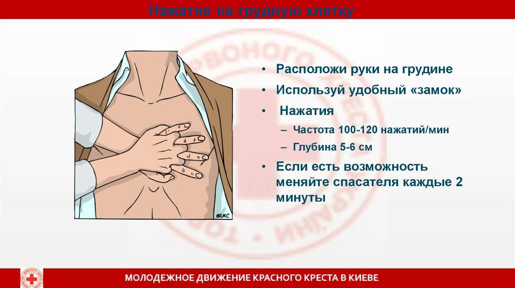 Частота надавливания при компрессии грудной клетки составляет. Надавливание на грудную клетку. Нажатия на грудную клетку. При надавливании на грудную клетку руками. Нажать на грудную клетку.