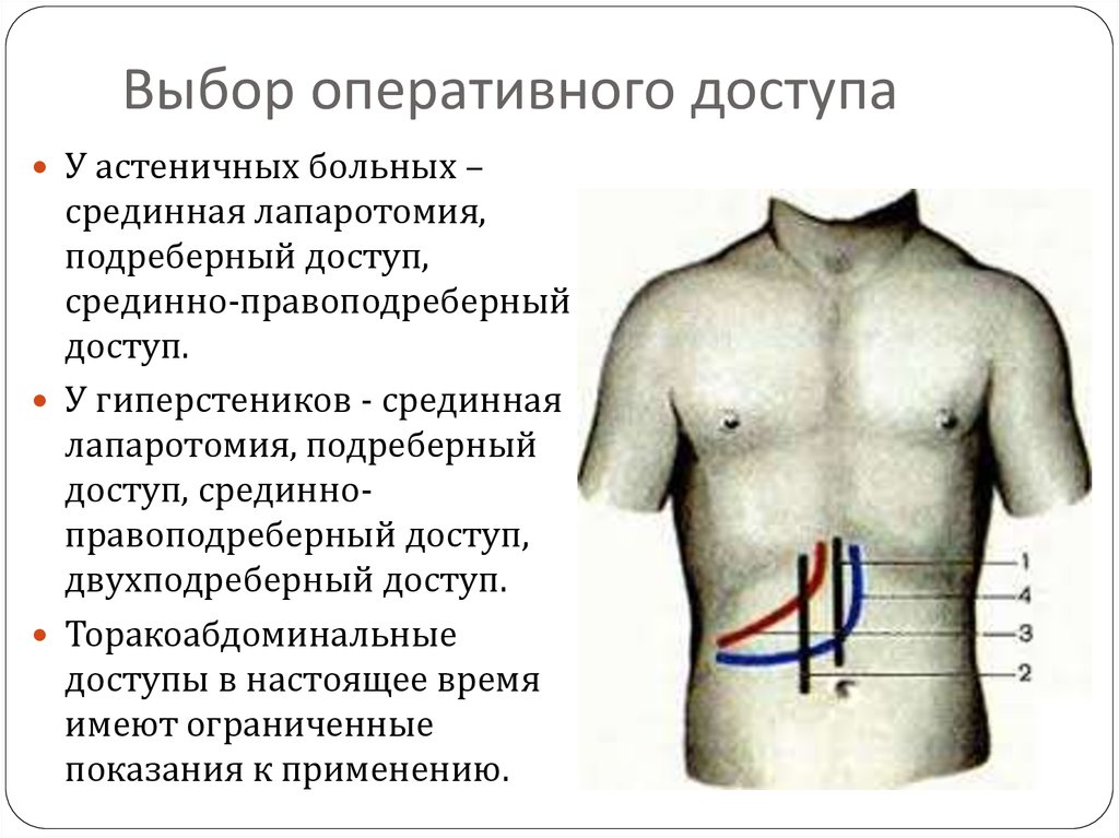 Лапаротомия показания