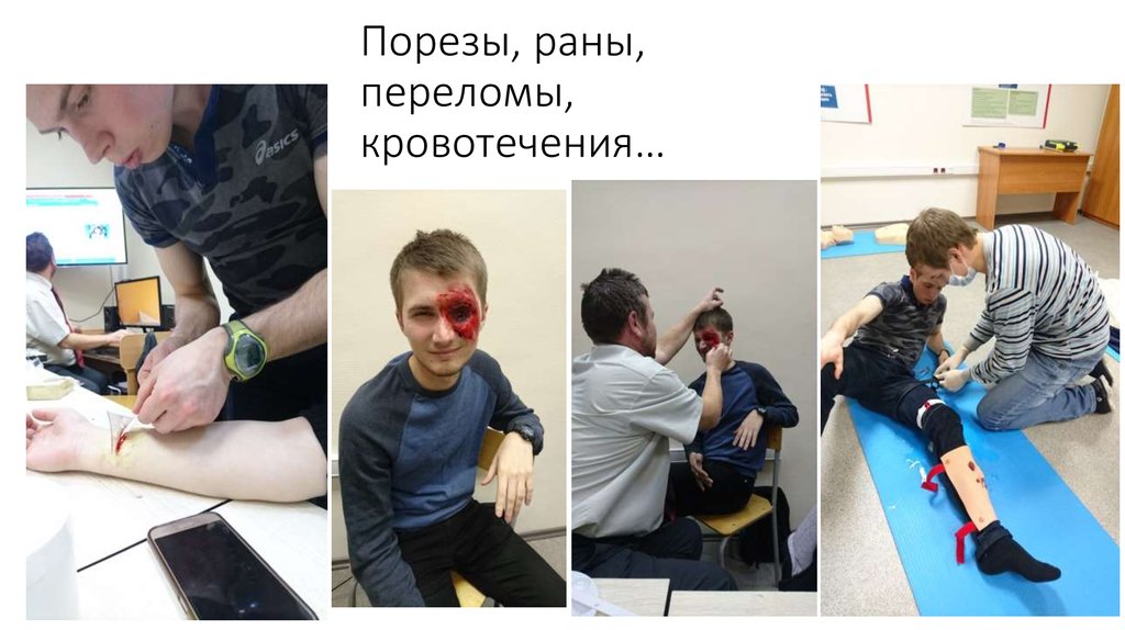 Порезы, раны, переломы, кровотечения…