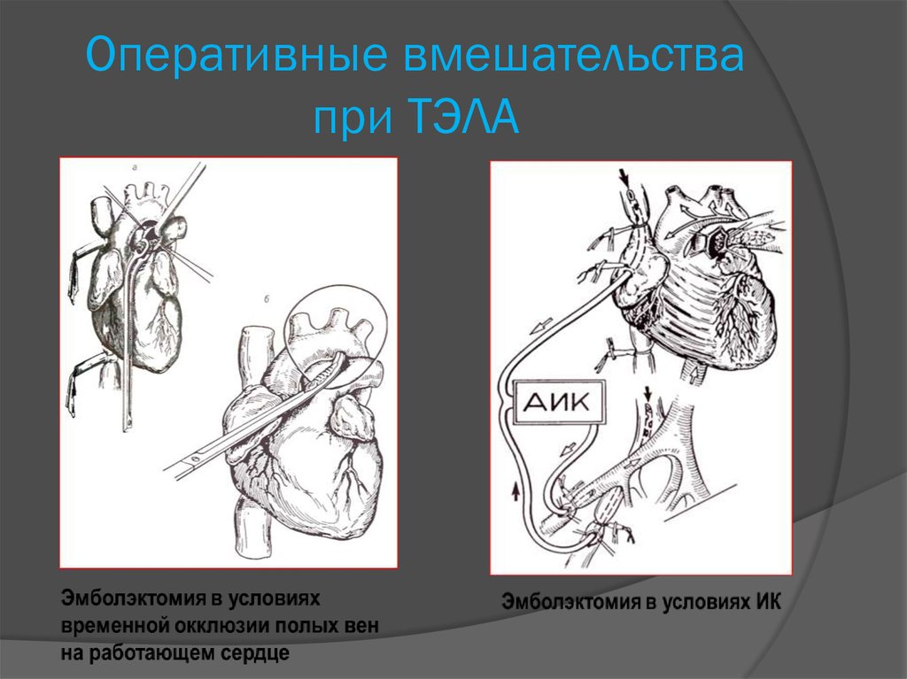 Тэла презентация хирургия