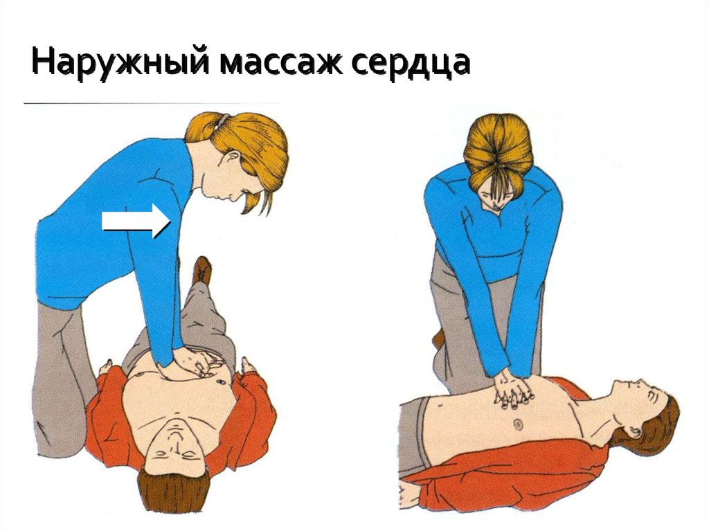 Презентация массаж сердца