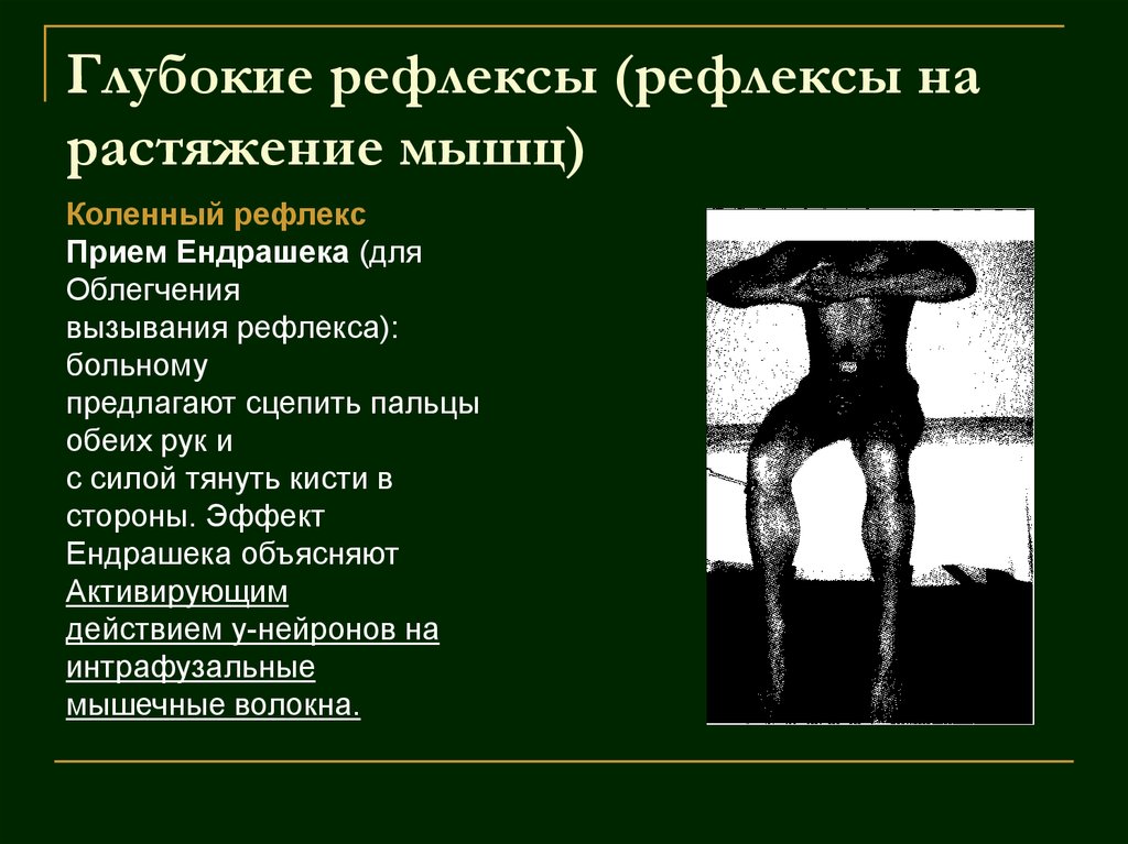 Сухожильные и кожные рефлексы их значение. 5 сухожильных рефлексов. Сухожильные и кожные рефлексы их значение. Сухожильные и кожные рефлексы их значение. Патологические рефлексы в неврологии таблица.