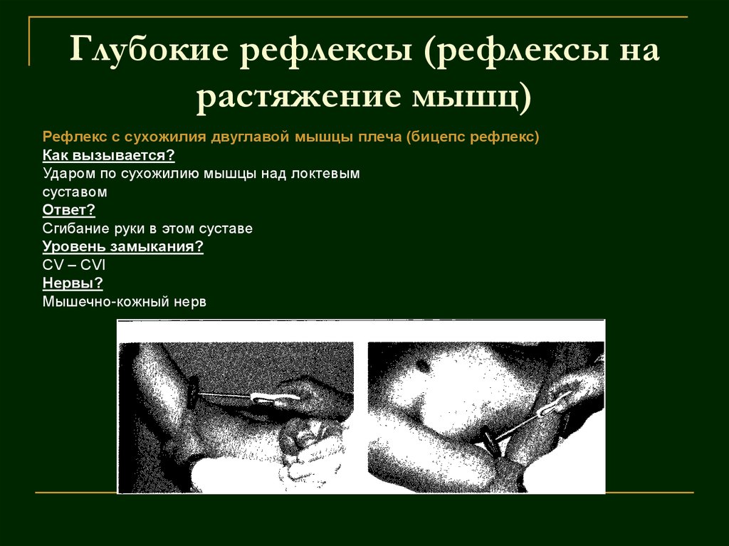 Глубокие рефлексы (рефлексы на растяжение мышц)