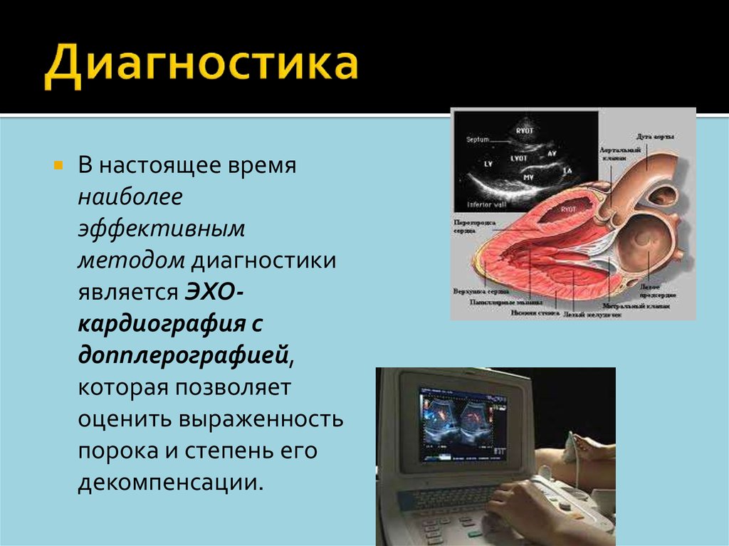 Диагностика является. Метод диагностики пороков сердца. Методы диагностики при пороки сердца. Наиболее информативные методы диагностики пороков сердца. Наиболее важным методом диагностики пороков сердца является.