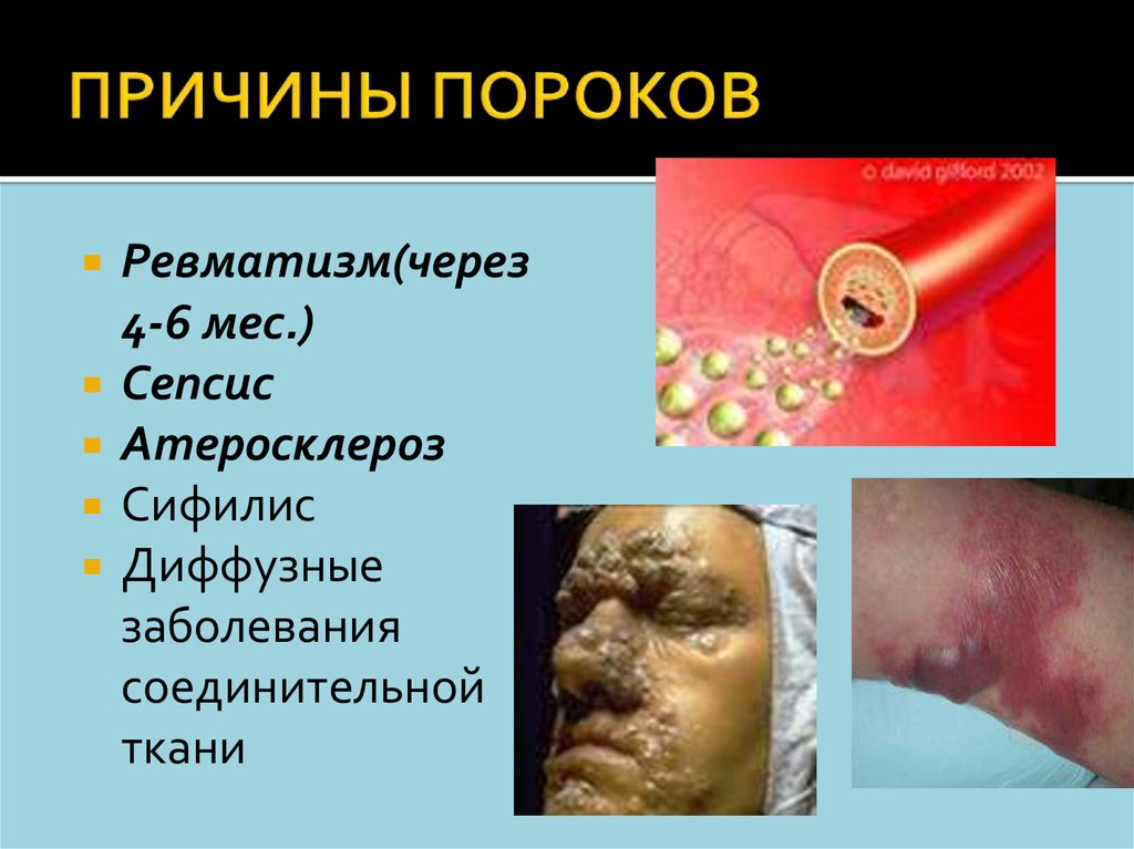 ПРИЧИНЫ ПОРОКОВ