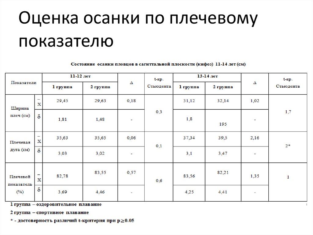 Статистика нарушения осанки