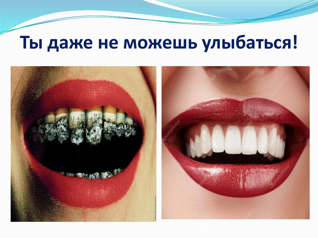 Ты даже не можешь улыбаться!