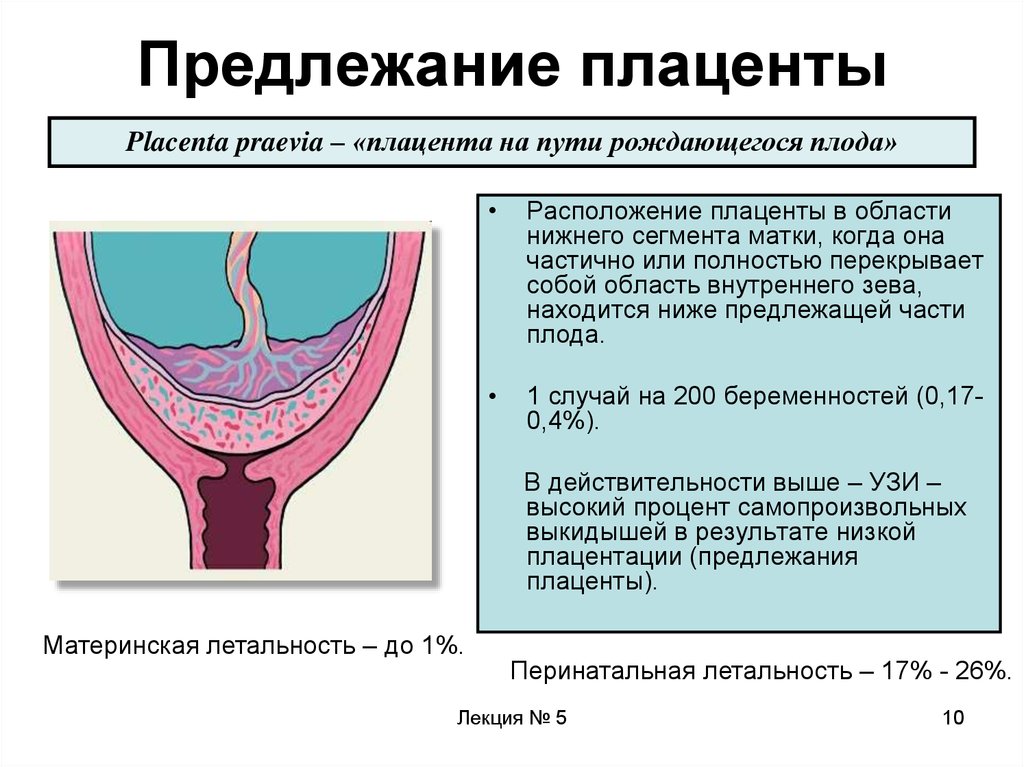 Тонус передней стенки матки. Нижнее предлежание плаценты при беременности. Неполное предлежание плаценты на УЗИ. Краевое предлежание плаценты у беременных. Шеечное предлежание плаценты.