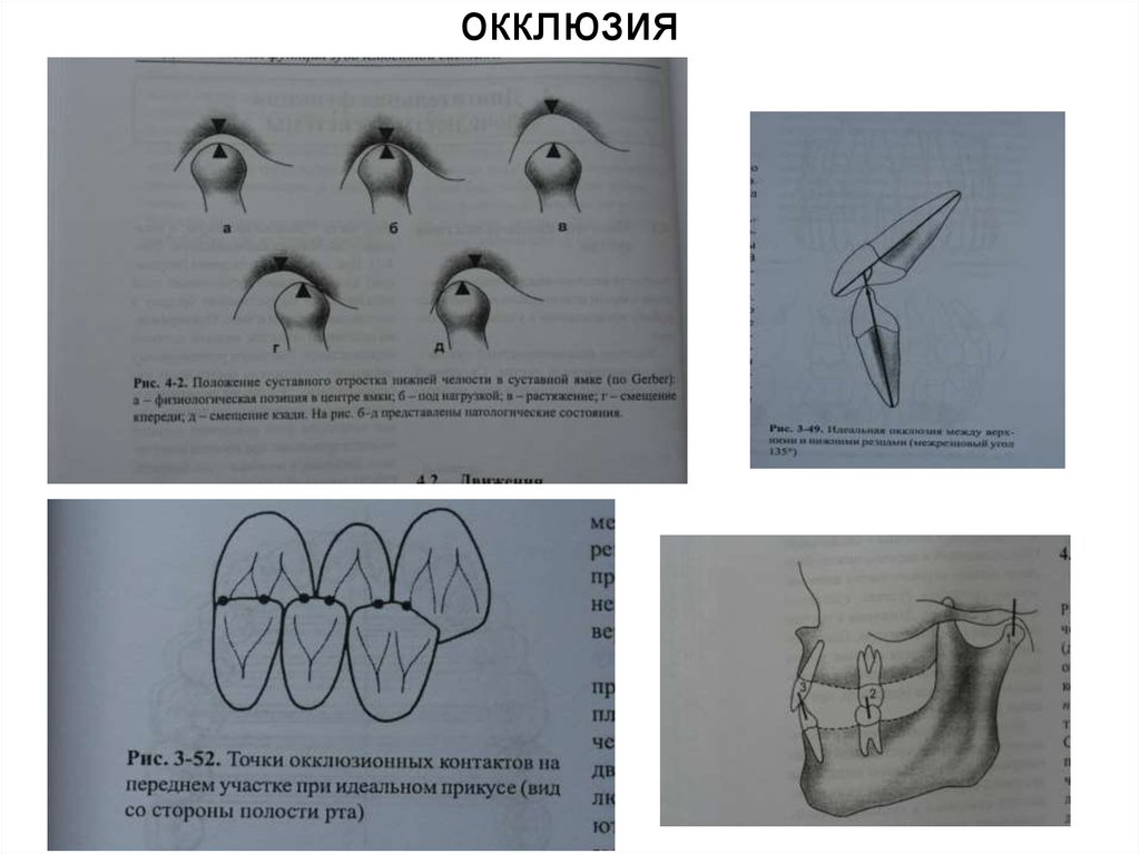 Биомеханика нижней челюсти. Артикуляция и окклюзия. Окклюзия нижней челюсти. Артикуляция нижней челюсти.