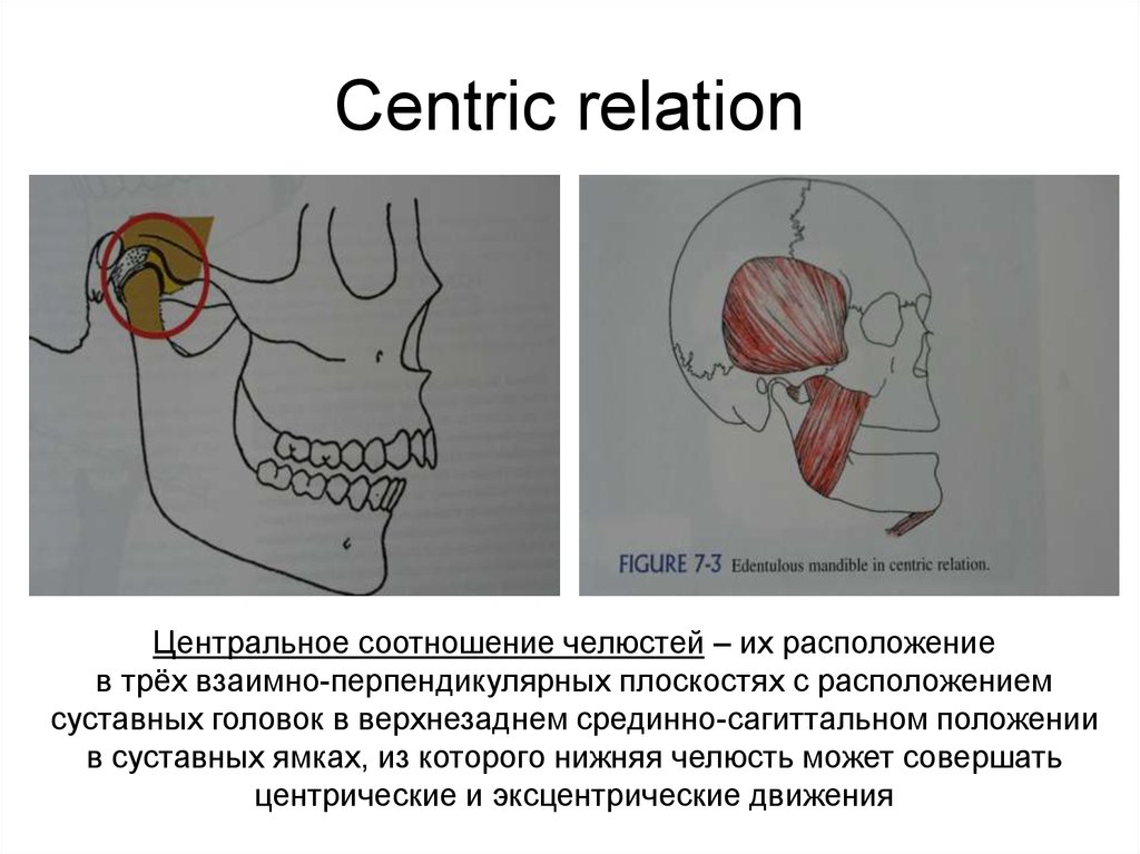 Центральное расположение. Центральная окклюзия и центральное соотношение. Понятие о Центральном соотношении челюстей. Центральная окклюзия и центральное соотношение челюстей. Прикус центральное соотношение челюстей.