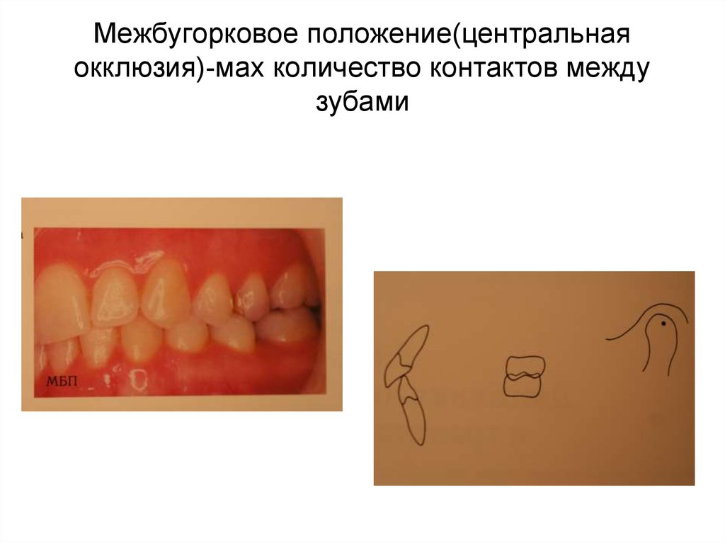 Центральной окклюзии зубной. Центральная окклюзия. Центральная окклюзия зубов. Центральная окклюзия челюстей это. Артикуляция и окклюзия.