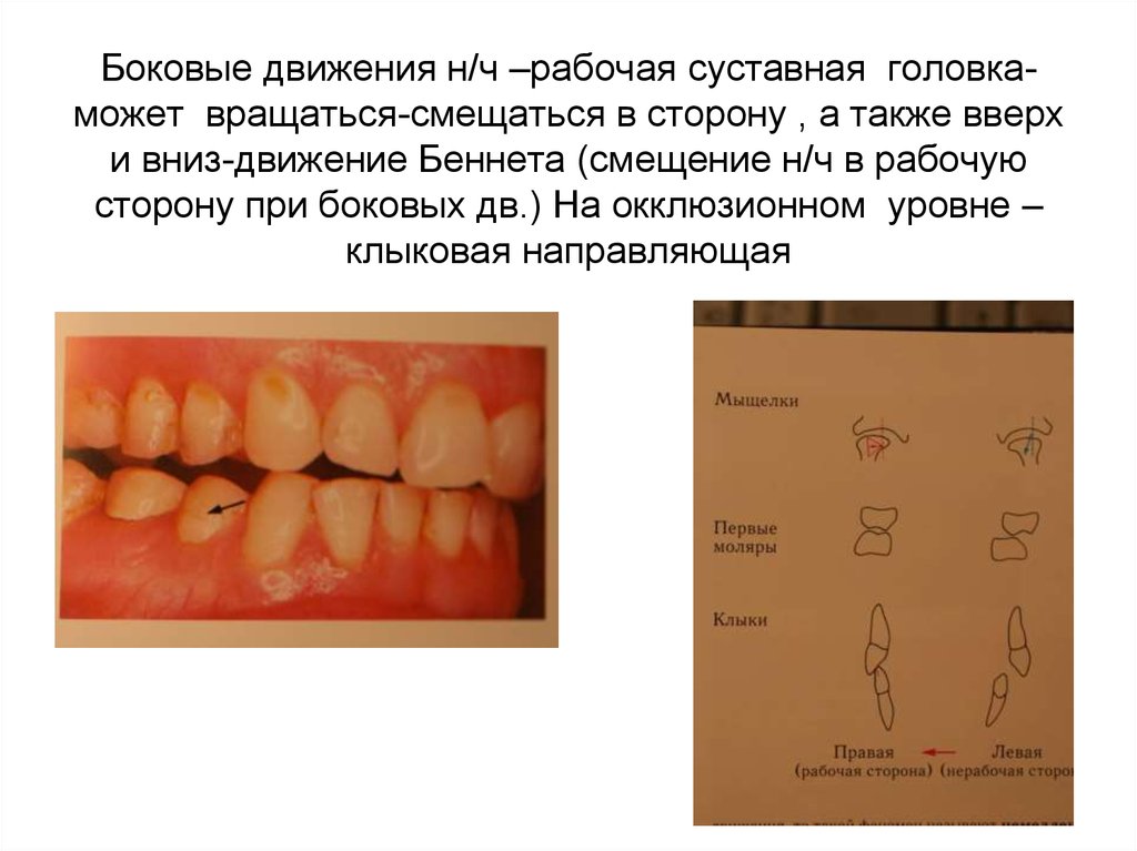 Боковая окклюзия. Резцовое и Клыковое ведение. Артикуляция и окклюзия.