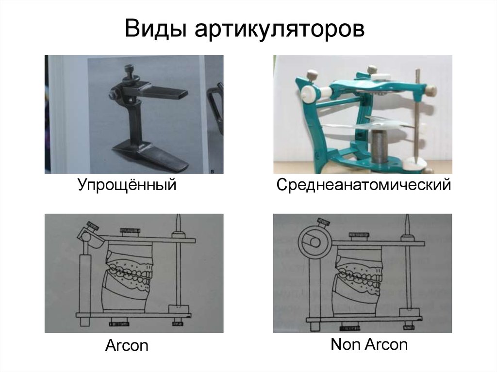 Окклюдатор и артикулятор презентация