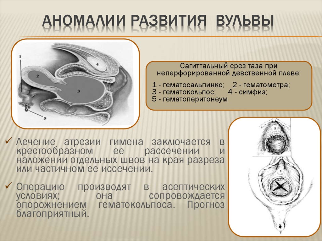 Аномалии развития яичников презентация