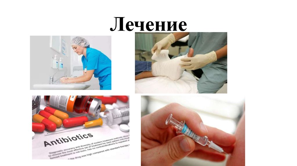 Лечение
