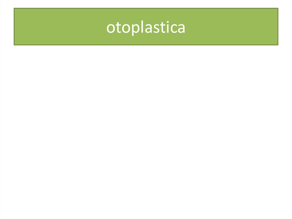 otoplastica