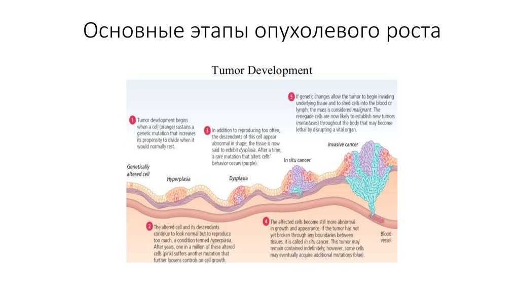 Виды опухолевого роста схема - 97 фото