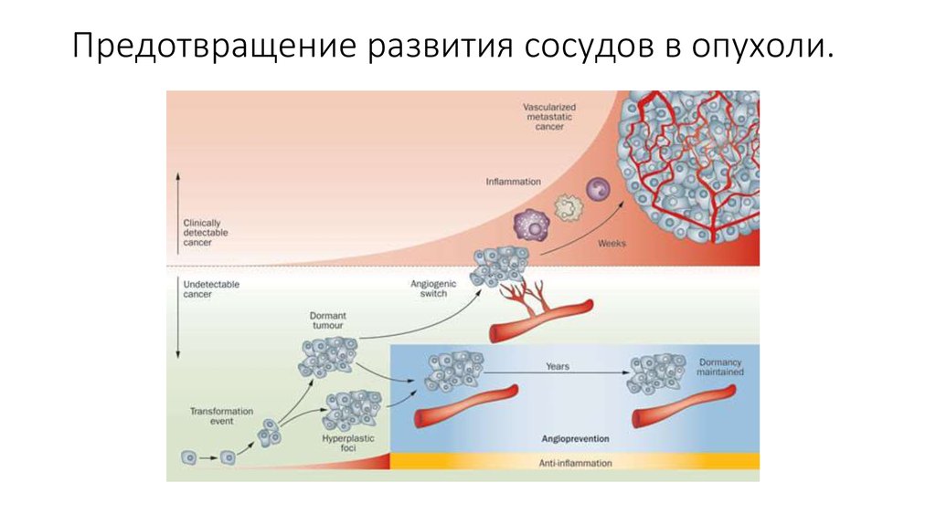 Рак сосудов. Опухоли кровеносных сосудов. Злокачественные опухоли кровеносных сосудов. Опухоли кровеносных сосудов доброкачественные и злокачественные. Опухоли сосудов классификация.