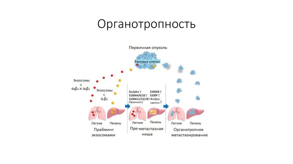 Подпишите картинки виды опухолевого роста