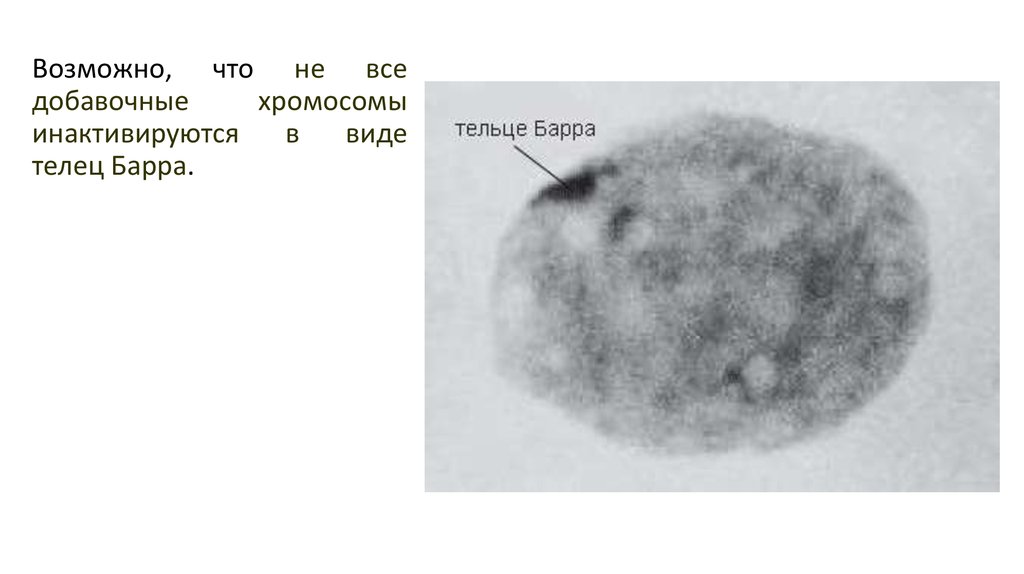 Тельце барра. Половой хроматин тельце Барра. Тельца полового хроматина. Таблица половой хроматин тельце Барра. Половой хроматин под микроскопом.