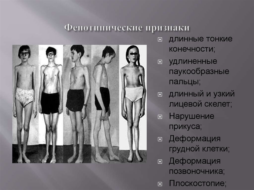 Фенотипические признаки