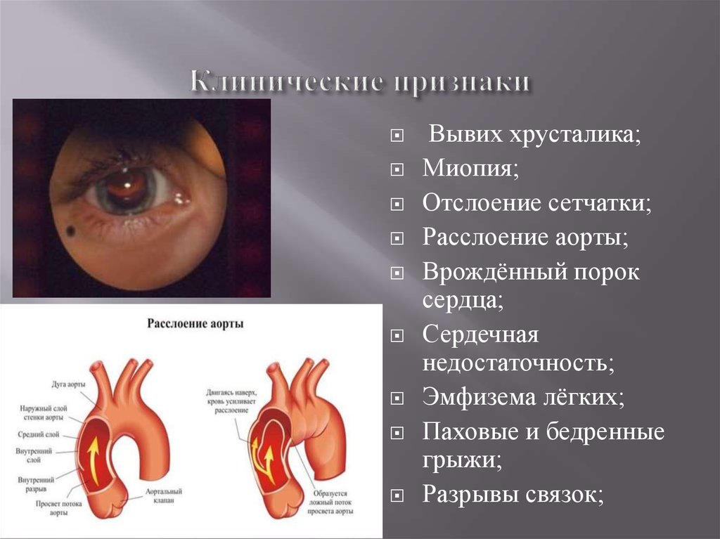 Клинические признаки