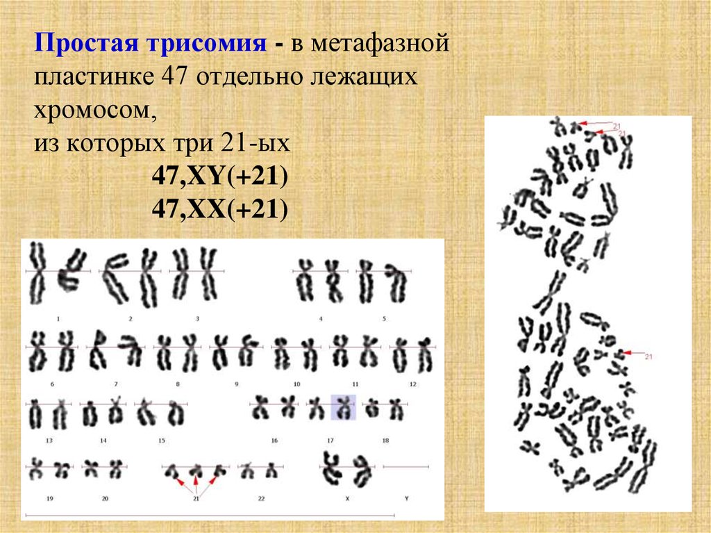 Метафазная пластинка