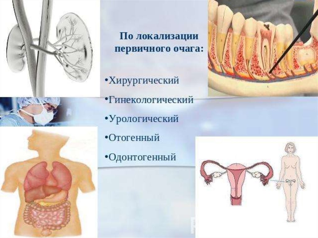 Стоматогенный очаг инфекции презентация