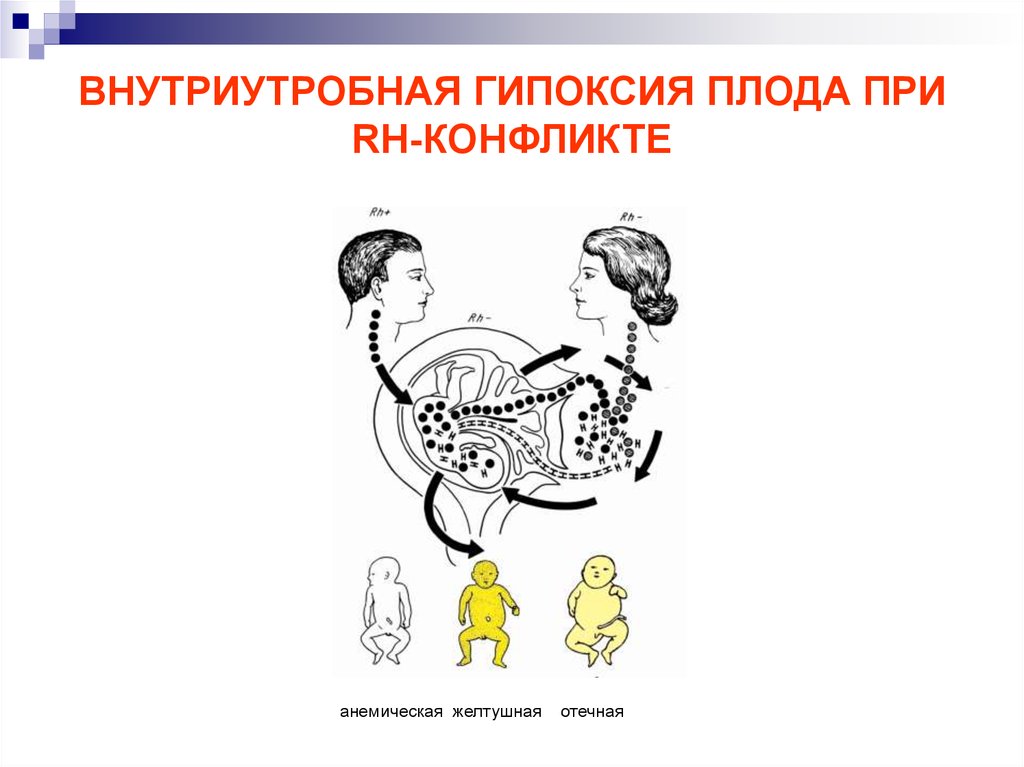 Гипоксия плода классификация