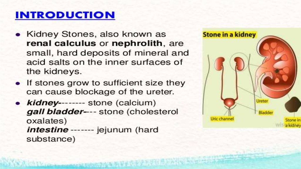 Kidney stone перевод