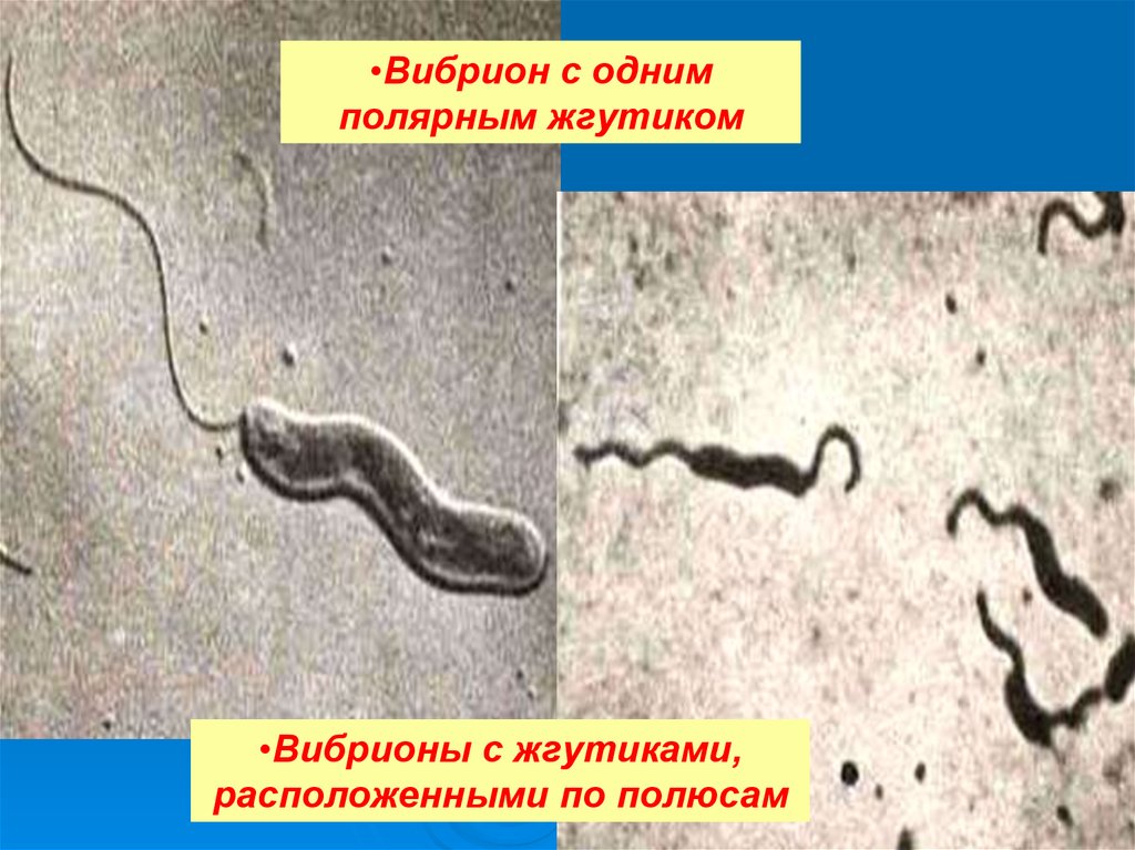 Организм трутовик окаймленный холерный вибрион