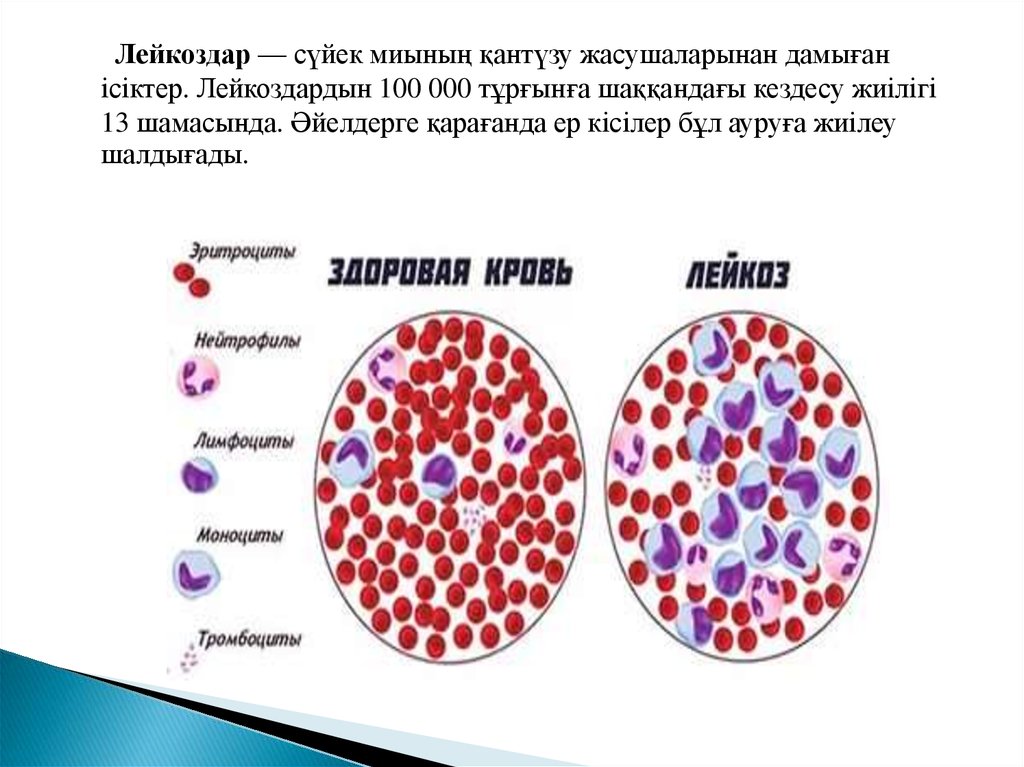 Созылмалы лимфолейкоз презентация