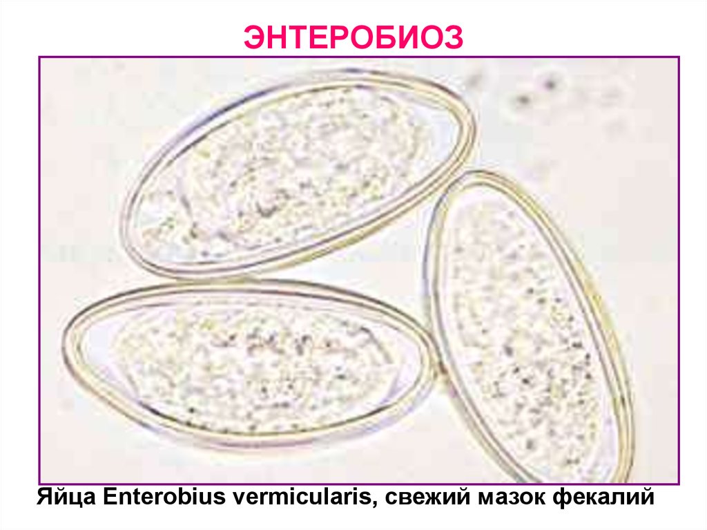 Яйца остриц. Enterobius vermicularis яйца. Яйца глистов Enterobius vermicularis. Enterobius vermicularis яйца под микроскопом. Яйца остриц под микроскопом.